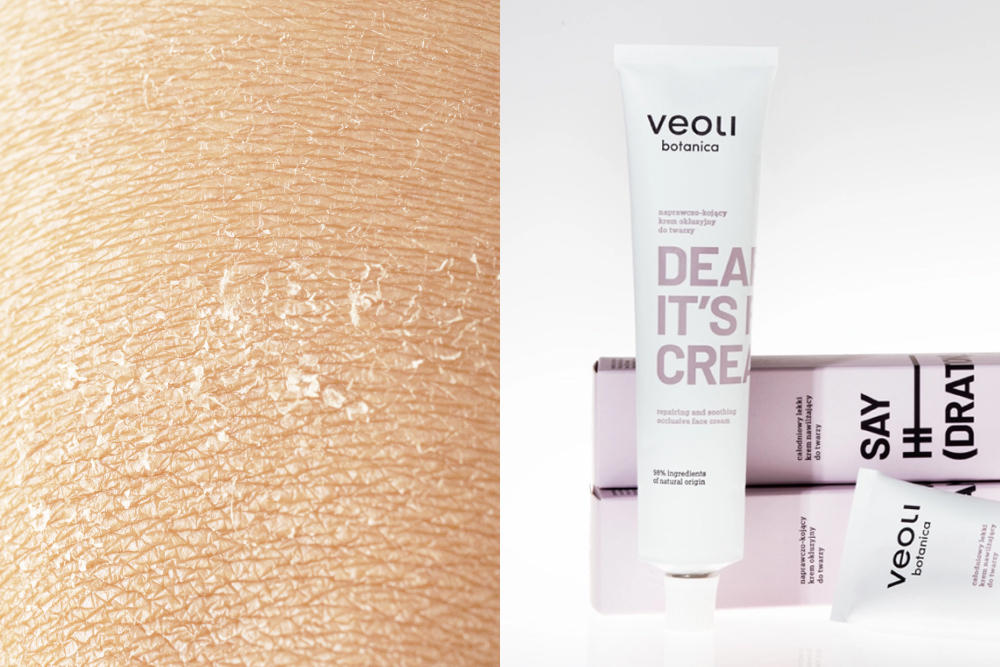 Odbudowa bariery hydrolipidowej: metamorfoza skóry mieszanej