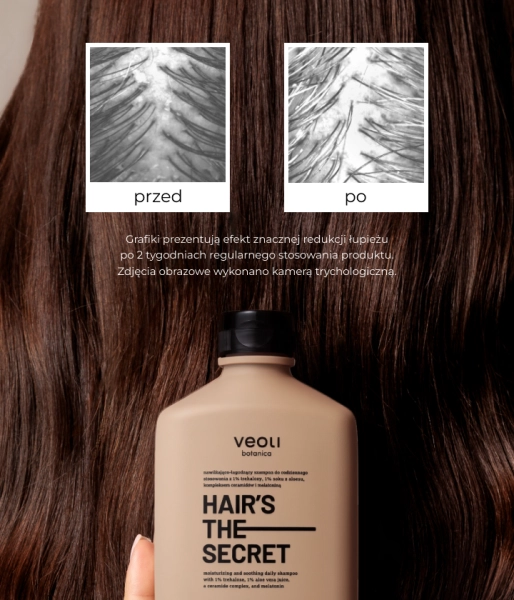 Moisturizing and soothing daily shampoo with 1% trehalose, 1% aloe vera juice, a ceramide complex, and melatonin HAIR'S THE SECRET