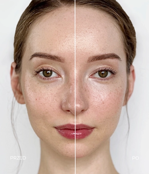 Brightening, lifting and repairing eye and eyelid serum with caffeine, peptides, hyaluronic acid and the Beautifeye™️ complex 20 SECONDS MAGIC EYE TREATMENT GLAM