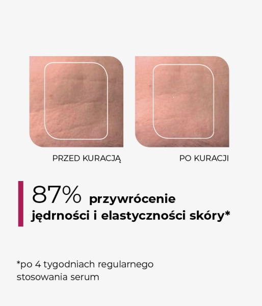 Natychmiastowo liftingujące, anti-aging serum emulsyjne z roślinnym zamiennikiem retinolu i Fision® Instant Lift FOCUS LIFTING MILK