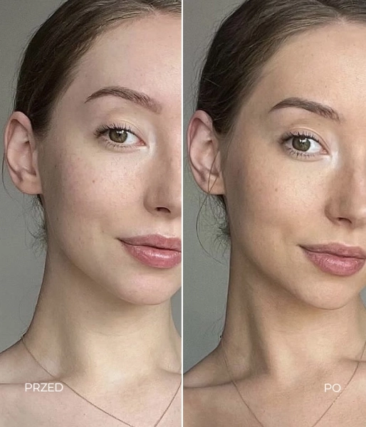 Bronzing drops for the face,  neck and decolletage with  hyaluronic acid and peach  blossom extract CATCH THE SUN