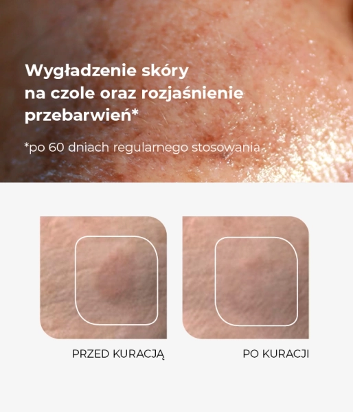 Skin discolouration serum with Niacinamide and vitamin C FOCUS PIGMENTATION ESSENCE 