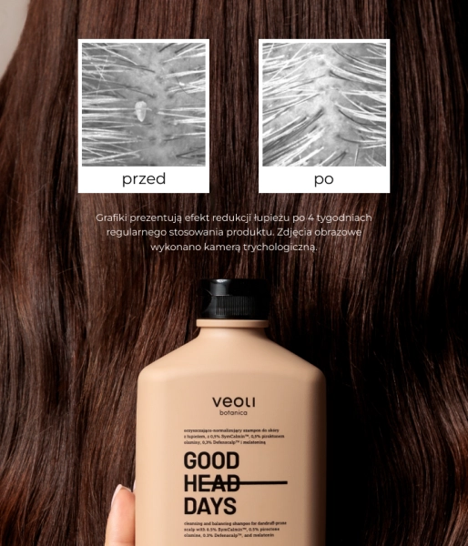 Cleansing and balancing shampoo for dandruff-prone scalp with 0.5% SymCalmin™, 0.5% piroctone olamine, 0.3% Defenscalp™, and melatonin GOOD HEAD DAYS