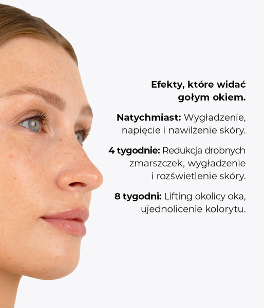 Brightening and firming under-eye peel with a 6% acid complex and 2% keratolin THE PEELUMINATOR