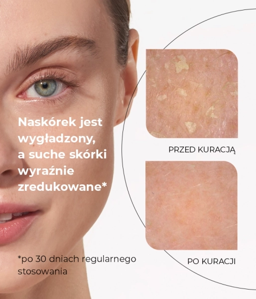  Serum nawilżające z kwasem hialuronowym 0,6% FOCUS HYDRATION GEL