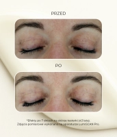 Rozjaśniająco-nawilżające serum na cienie pod oczy i na powieki z peptydem wybielającym 1%, kwasem traneksamowym 0,5% i glutationem EYE SEE NO SPOTS