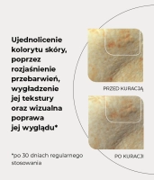  Peeling enzymatyczny z kompleksem kwasów AHA Phytocomplex 10%, PHA 10%, BHA - MATCHA POWER PEEL