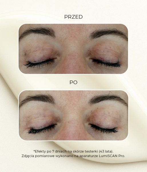 Rozjaśniająco-nawilżające serum na cienie pod oczy i na powieki z peptydem wybielającym 1%, kwasem traneksamowym 0,5% i glutationem EYE SEE NO SPOTS