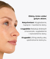 Brightening and firming under-eye peel with a 6% acid complex and 2% keratolin THE PEELUMINATOR