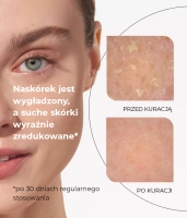 Ultra-hydrating gel serum with Triple Hyaluronic Acid Complex and KombuchkaTM Black Tea Ferment™ FOCUS HYDRATION GEL